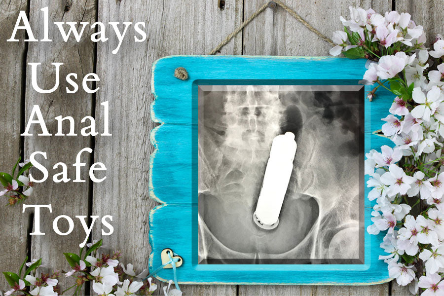CAT Scan (Xray) Anal Dildo Stuck